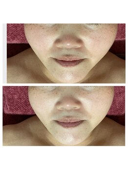 紫檀(シタン)/美肌♪小顔♪ハリ艶！