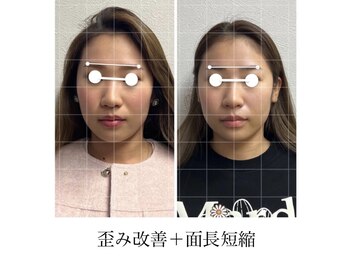 ラボーテヴェリテ(La Beaute Verite)/【お客様施術例】