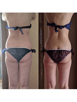 サロンドルポゼ(Salon de reposer)/