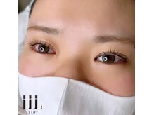 エニー(Any)/L3ラッシュリフト