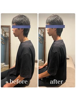 フィジオリハ 久屋大通店/筋膜リリース/ストレートネック