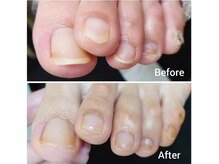 リゼラアンドコー 盛岡店/ドイツ式フットケア専門店