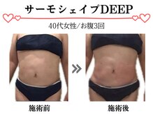 スパイア(SPIRE)/サーモシェイプDEEP★お腹