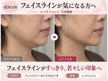 サンテビスタ 本八幡(Sante ViSta)の写真