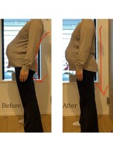 ジェミニ 乃木坂(Gemini)/反り腰を和らげる