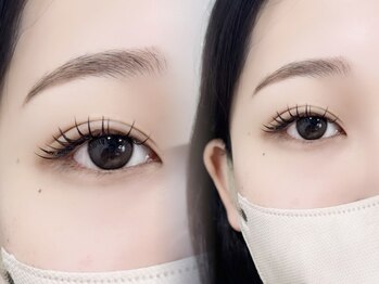 ロピ 江坂(LOPI)/バインドロック80束