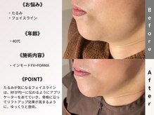 ルディラ 大宮店/インモードFX+FORMA