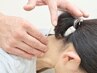 二回以降はこちら！！鍼灸+リラクゼーションコース3800円→3000円