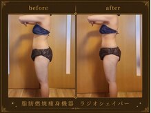 セオリー(Theory)/お腹Before→After
