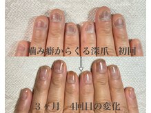 スティラ(Stila)の雰囲気（諦めていた爪がこんなに変化する！その爪プロにお任せください）