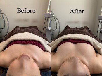 ジェイオー(J.O)/バストアップコルギ/小顔コルギ