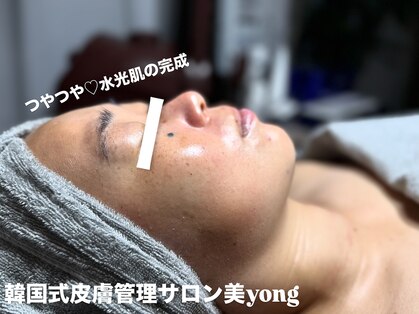ミヨン(美Yong)の写真