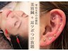 【平日15時以降限定】美容鍼 + 耳つぼジュエリーつけ放題　16,500円→9,900円