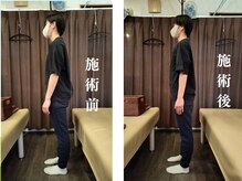 成心整体院/江東区の成心整体院 ★姿勢矯正