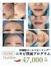 【期間限定】ニキビ撲滅プログラム |肌質改善 幹細胞ゴールドピーリング