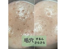 メナードフェイシャルサロン 宮の沢の雰囲気（毛穴の汚れを徹底除去！ザラつきのおるお肌がスベスベに☆）