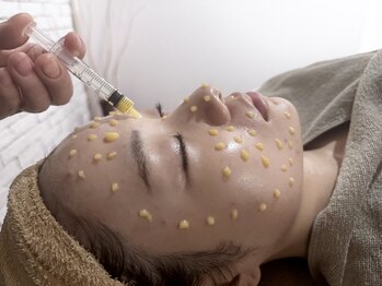 ルミエール シーサイド(L’MIERE seaside)の写真/【レチノール×2400万本のマイクロニードルで肌改善】ハリのなさ・開き毛穴・たるみが気になる方に。