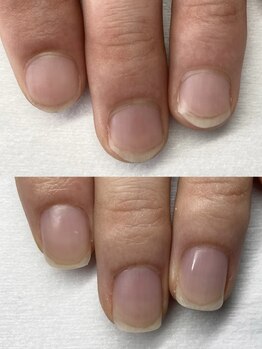 爪の悩みを解消できる（ケア含む）