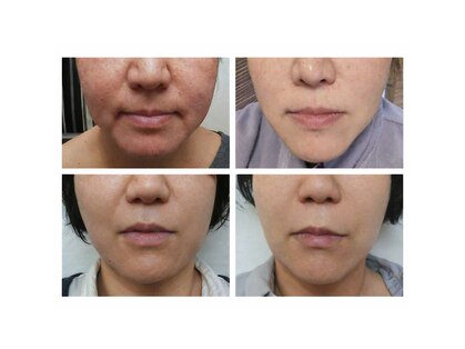 サロンルーチェ(Salon Luce)の写真