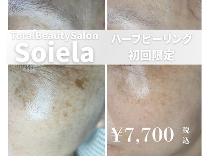 ソワラ(Soiela)の写真