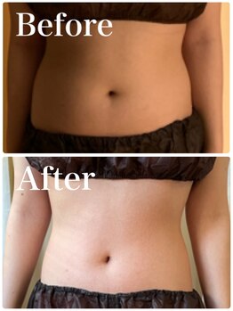 小顔屋ゆらやぎ/