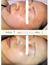 プリュベル(+belle)/◇お客様before after◇