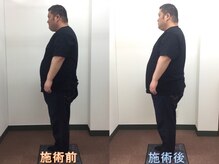 心笑整体院/施術