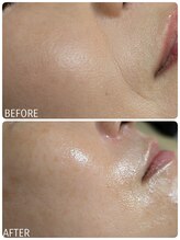 リラ(LiLas)/ファットアップセラム知ってる？