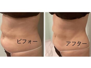 メディカルエステ ユウ(Yuu)/痩身専門店だから安心