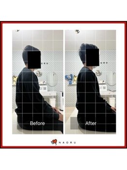 ナオル整体 北千住院(NAORU整体)/姿勢改善