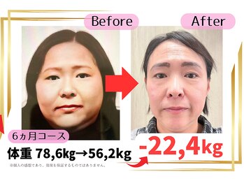 国分寺整体からだばらんす/70キロダイエット・痩身