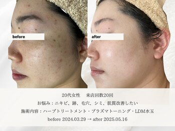 エメ(aimer)/SkinCare《肌管理・エイジング》