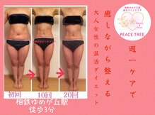 ピースツリー(PEACE TREE)