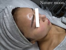 ナチュールムーン(Nature moon.)/ハーブピーリング　after