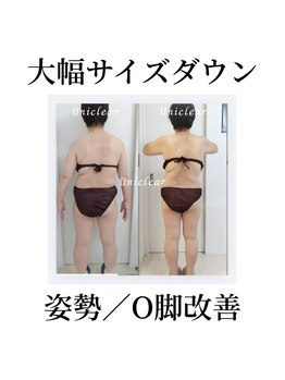 ユニクリア 佐賀(Uniclear)の写真/夏に向けてダイエットはユニクリアの美・痩身で決まり!運動や食事制限で変化がなかった人に理想のボディ