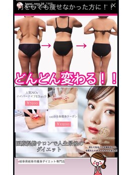 アールズ スリム(R's slim)/年齢なんて関係ない!痩身専門店