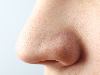 ピピ(pipi)/毛穴黒ずみ・毛穴ケアも◎