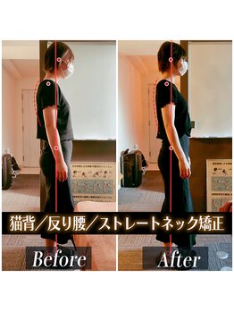 てんてんてんまてん/姿勢矯正/骨盤矯正/整体/巻き肩