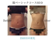 リープル(Leapl)/【腸もみ】腸もみ後の変化写真