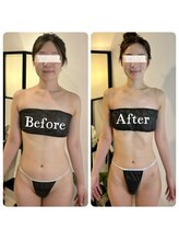 蒼(so)/小顔矯正・顔&頭は2回り小さく！