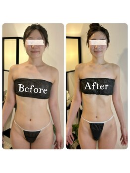 蒼(so)/小顔矯正・顔&頭は2回り小さく!