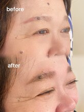 ミーククル(MEKUKURU)/眉毛-ハリウッドブロウリフト