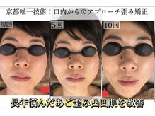 サロンチオリ 烏丸(Salon Chiori)/骨格から変わる小顔矯正