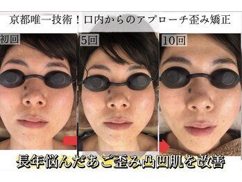 サロンチオリ 烏丸(Salon Chiori)/骨格から変わる小顔矯正