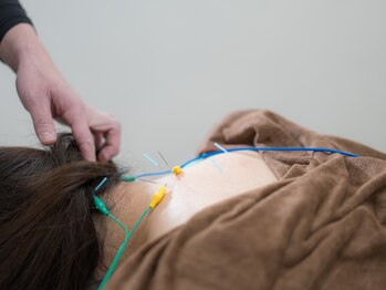 名古屋鍼灸 美容健康院の写真/年齢に応じたお手入れを始めたい方、これからも健やかに過ごしたい方へ◇