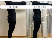 ヨサパーク ノワール(YOSA PARK Noir)/ルルオン4回