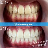 ホワイトニングカフェ 苫小牧店(WhiteningCafe)