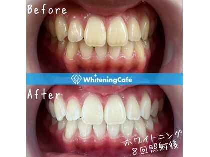 ホワイトニングカフェ 苫小牧店(WhiteningCafe)の写真