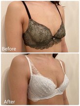 美人バスト 辻堂店/◇バストアップ/症例◇