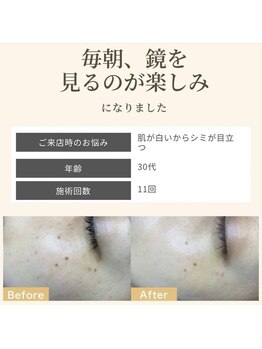 毛穴専科/鏡を見るのが楽しみに!?